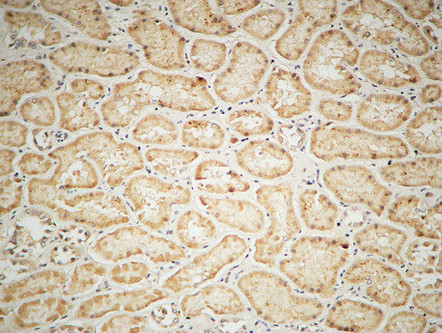 IGF-IR Rabbit Polyclonal Antibody | 兔多抗 | EnkiLife恩玑生命