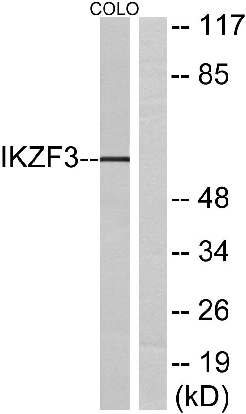 Ikaros 3 Rabbit Polyclonal Antibody | 兔多抗 | EnkiLife恩玑生命
