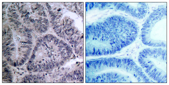 IKKα Rabbit Polyclonal Antibody | 兔多抗 | EnkiLife恩玑生命