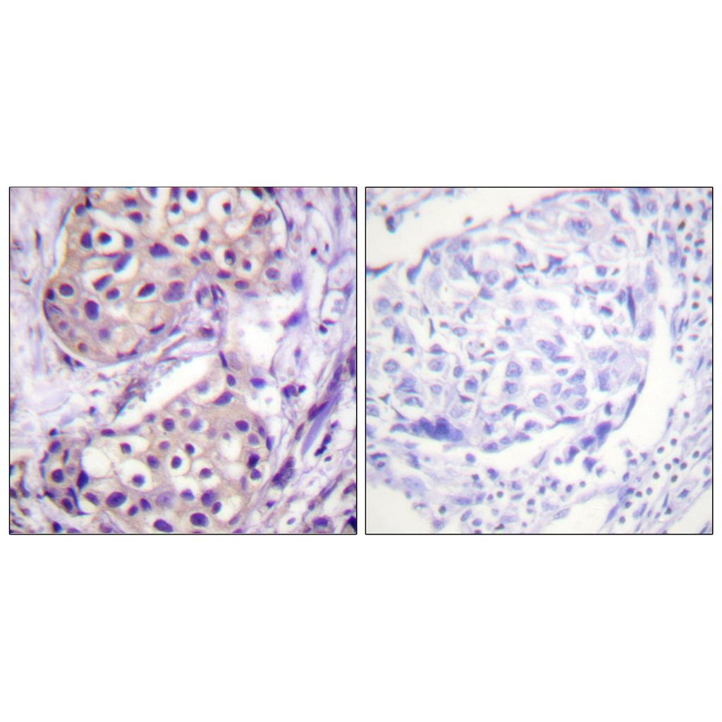 IKKβ Rabbit Polyclonal Antibody | 兔多抗 | EnkiLife恩玑生命