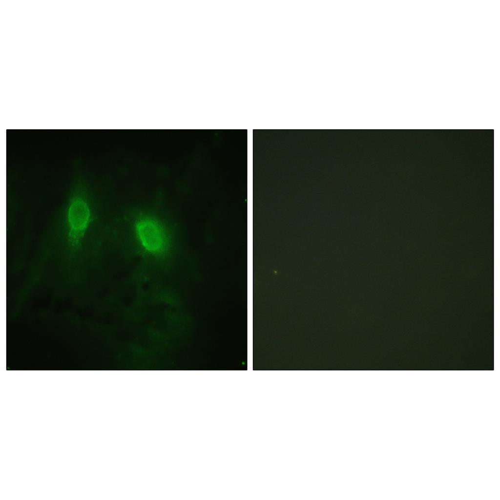 IKKγ Rabbit Polyclonal Antibody | 兔多抗 | EnkiLife恩玑生命