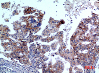 IL-1RII Rabbit Polyclonal Antibody | 兔多抗 | EnkiLife恩玑生命
