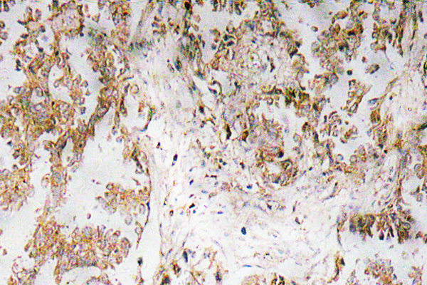 IL-1α Rabbit Polyclonal Antibody | 兔多抗 | EnkiLife恩玑生命