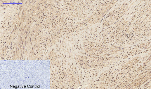 IL-1β Rabbit Polyclonal Antibody | 兔多抗 | EnkiLife恩玑生命