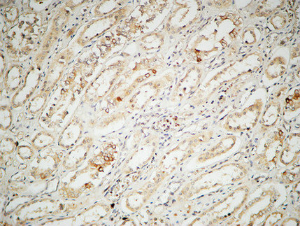 IL-2 Rabbit Polyclonal Antibody | 兔多抗 | EnkiLife恩玑生命