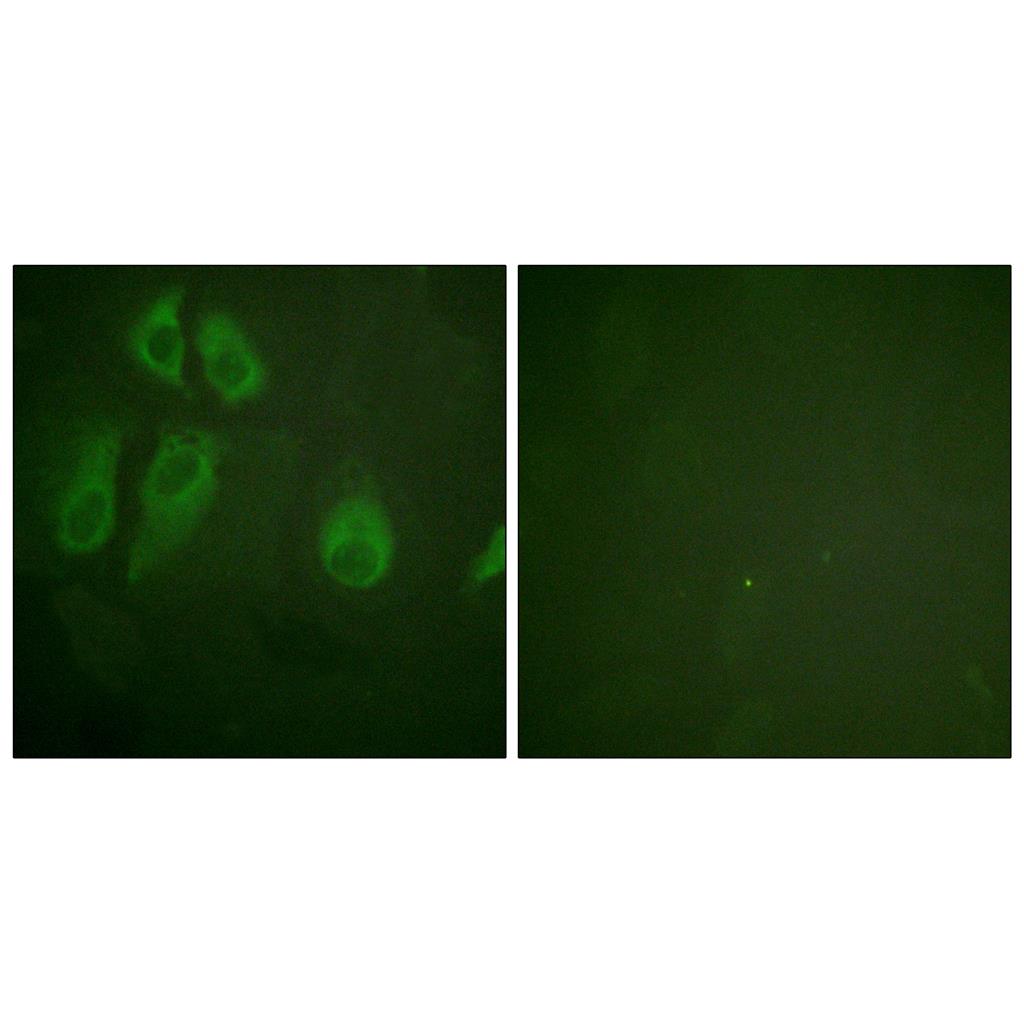 IL-2Rα Rabbit Polyclonal Antibody | 兔多抗 | EnkiLife恩玑生命