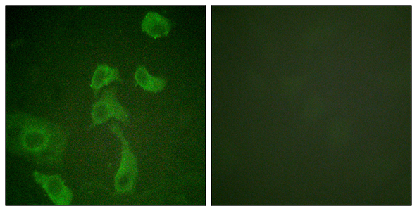 IL-2Rβ Rabbit Polyclonal Antibody | 兔多抗 | EnkiLife恩玑生命
