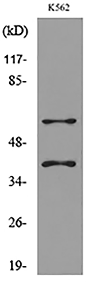 IL-2Rγ Rabbit Polyclonal Antibody | 兔多抗 | EnkiLife恩玑生命