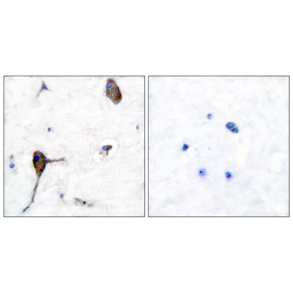 IL-3Rβ Rabbit Polyclonal Antibody | 兔多抗 | EnkiLife恩玑生命