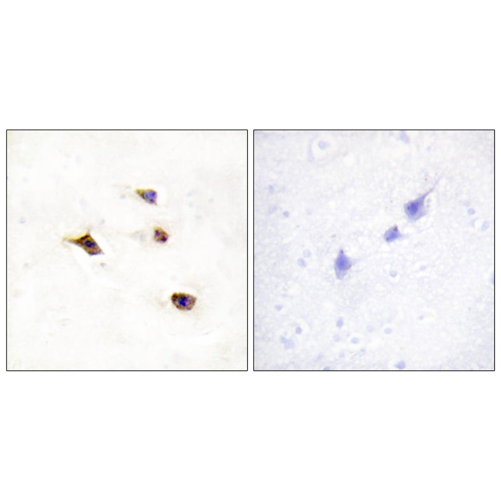 InsP6 Kinase 3 Rabbit Polyclonal Antibody | 兔多抗 | EnkiLife恩玑生命