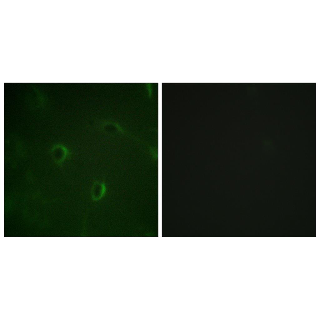 Insulin R Rabbit Polyclonal Antibody | 兔多抗 | EnkiLife恩玑生命