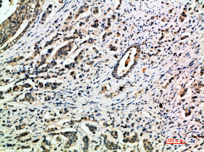 Integrin α1 Rabbit Polyclonal Antibody | 兔多抗 | EnkiLife恩玑生命