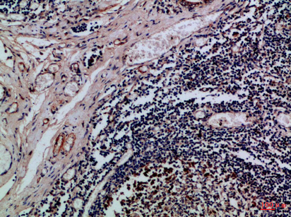 Integrin αE Rabbit Polyclonal Antibody | 兔多抗 | EnkiLife恩玑生命