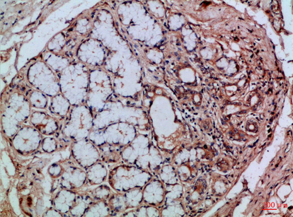 Integrin αE Rabbit Polyclonal Antibody | 兔多抗 | EnkiLife恩玑生命