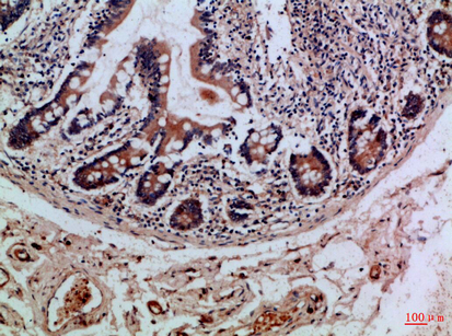 Integrin αE Rabbit Polyclonal Antibody | 兔多抗 | EnkiLife恩玑生命