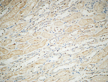 Integrin αV Rabbit Polyclonal Antibody | 兔多抗 | EnkiLife恩玑生命