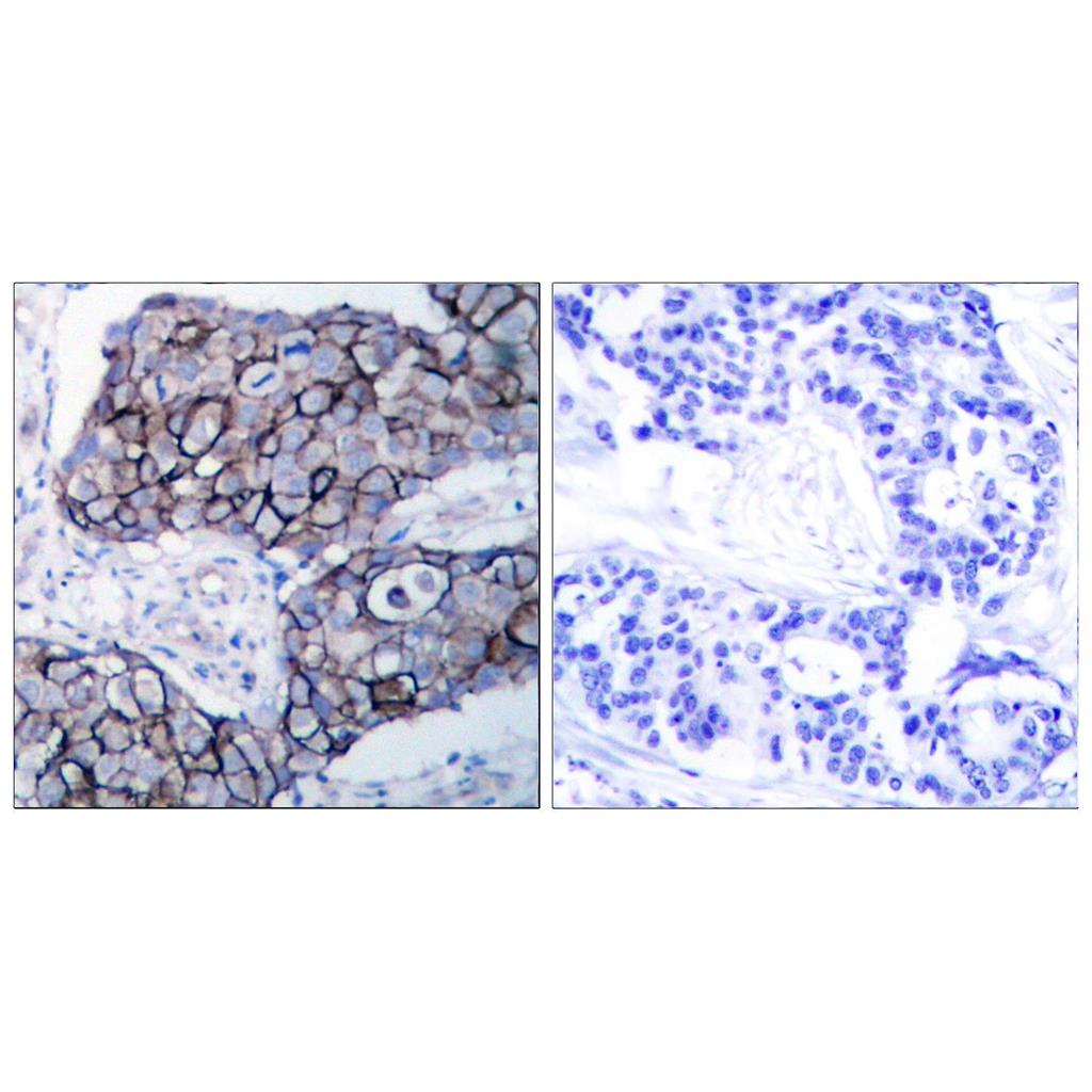 Integrin β3 Rabbit Polyclonal Antibody | 兔多抗 | EnkiLife恩玑生命