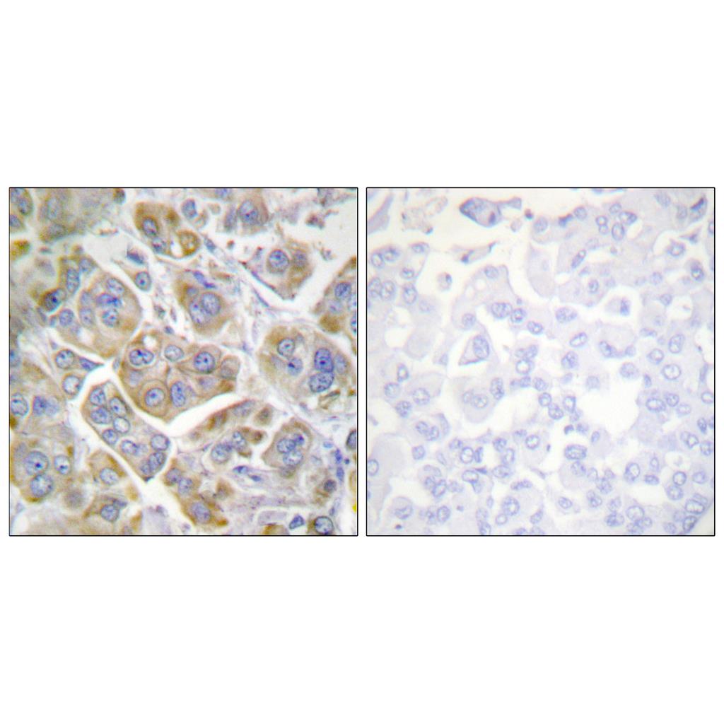 Integrin β4 Rabbit Polyclonal Antibody | 兔多抗 | EnkiLife恩玑生命