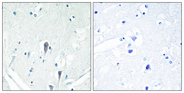 IRAK-M Rabbit Polyclonal Antibody | 兔多抗 | EnkiLife恩玑生命