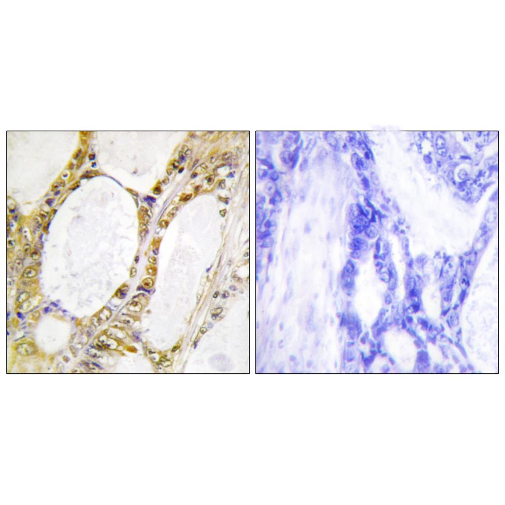 IRF-2 Rabbit Polyclonal Antibody | 兔多抗 | EnkiLife恩玑生命