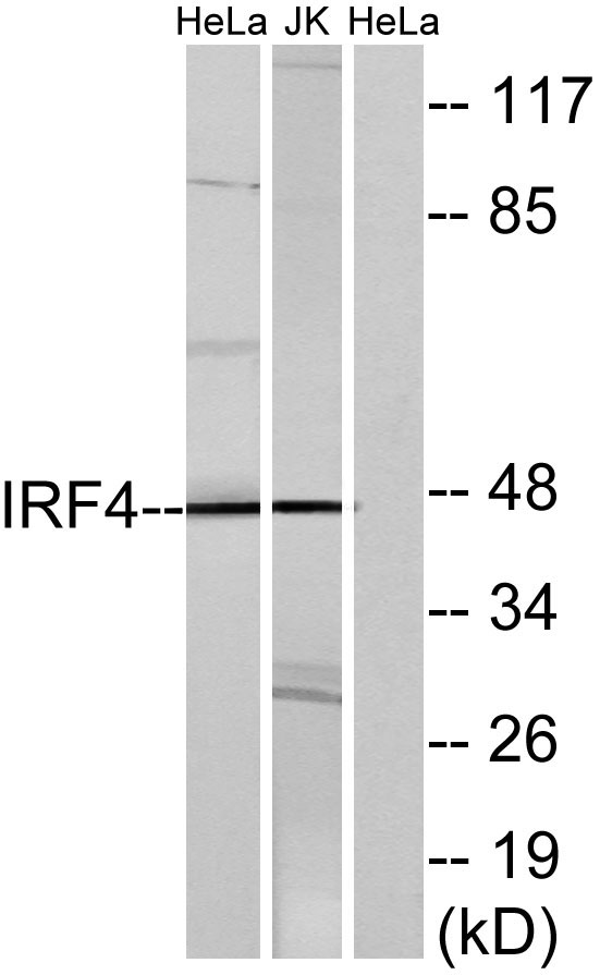 IRF-4 Rabbit Polyclonal Antibody | 兔多抗 | EnkiLife恩玑生命