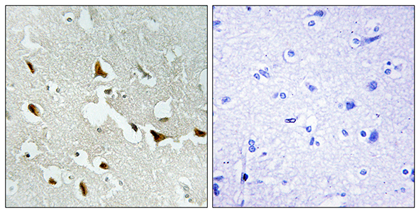 IRS-1 Rabbit Polyclonal Antibody | 兔多抗 | EnkiLife恩玑生命