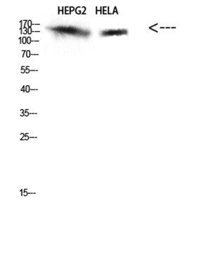 IRS2 Rabbit Polyclonal Antibody | 兔多抗 | EnkiLife恩玑生命