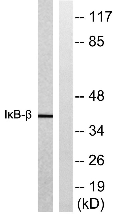 IκB-β Rabbit Polyclonal Antibody | 兔多抗 | EnkiLife恩玑生命