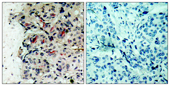 JAK1 Rabbit Polyclonal Antibody | 兔多抗 | EnkiLife恩玑生命