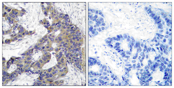 JAK2 Rabbit Polyclonal Antibody | 兔多抗 | EnkiLife恩玑生命