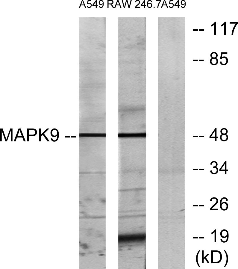 JNK2 Rabbit Polyclonal Antibody | 兔多抗 | EnkiLife恩玑生命