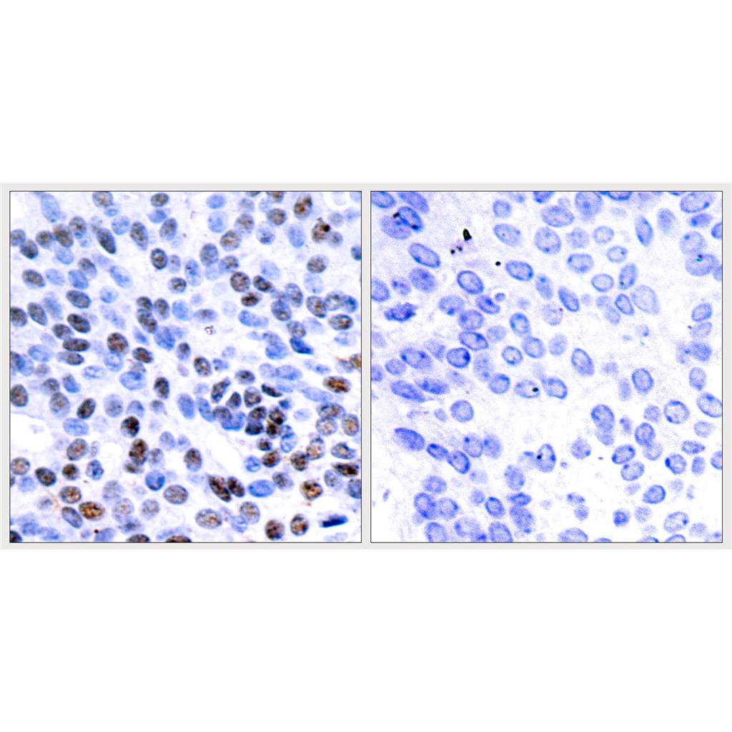 Jun B Rabbit Polyclonal Antibody | 兔多抗 | EnkiLife恩玑生命