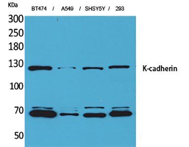 K-cadherin Rabbit Polyclonal Antibody | 兔多抗 | EnkiLife恩玑生命
