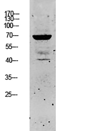 Keratin 5 Rabbit Polyclonal Antibody | 兔多抗 | EnkiLife恩玑生命