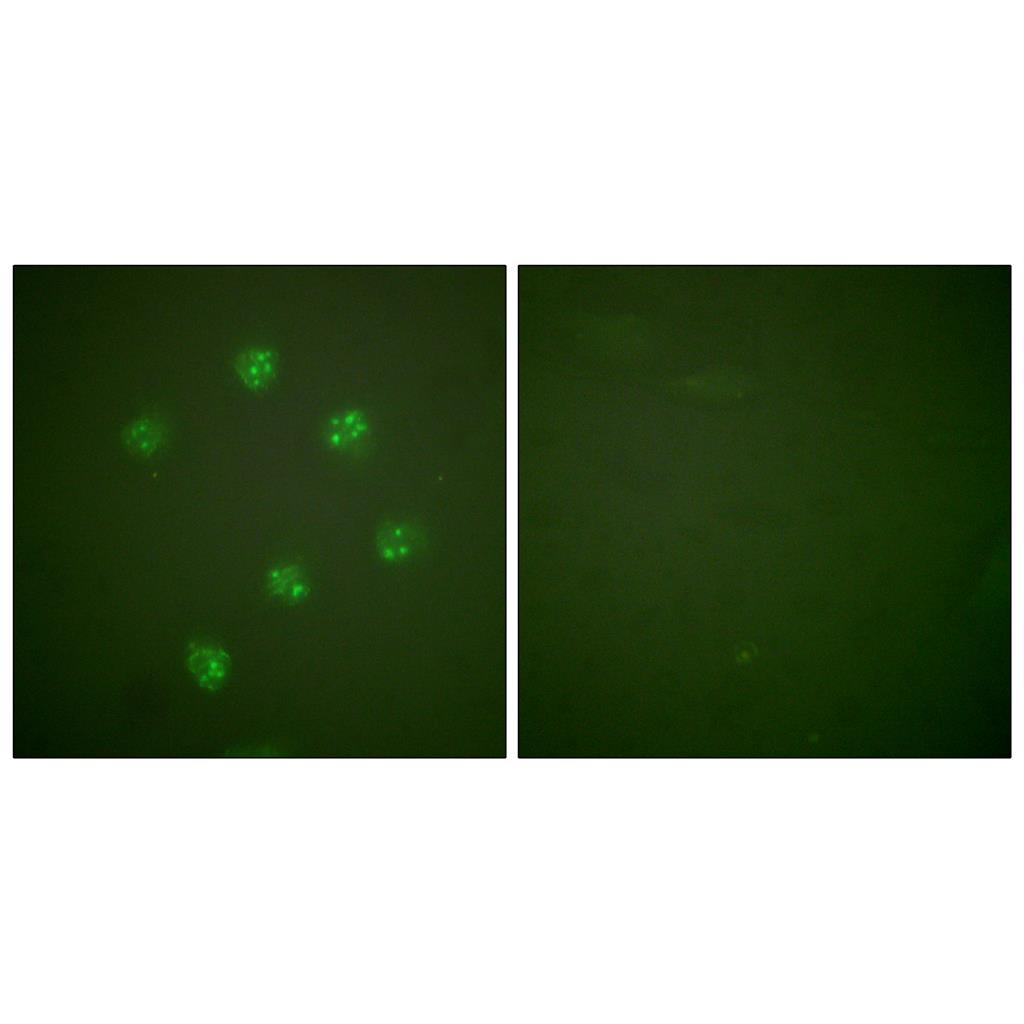 Ki-67 Rabbit Polyclonal Antibody | 兔多抗 | EnkiLife恩玑生命