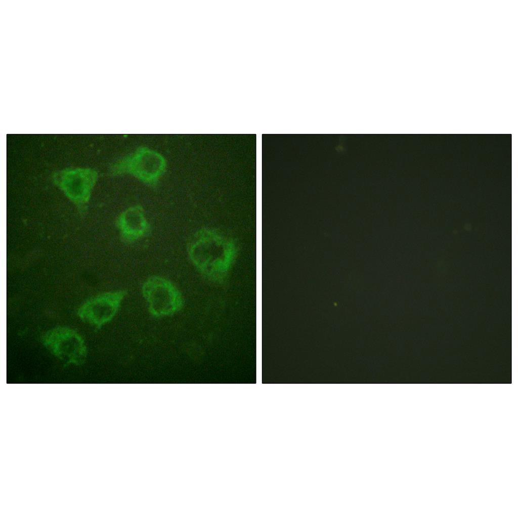 Ksr-1 Rabbit Polyclonal Antibody | 兔多抗 | EnkiLife恩玑生命