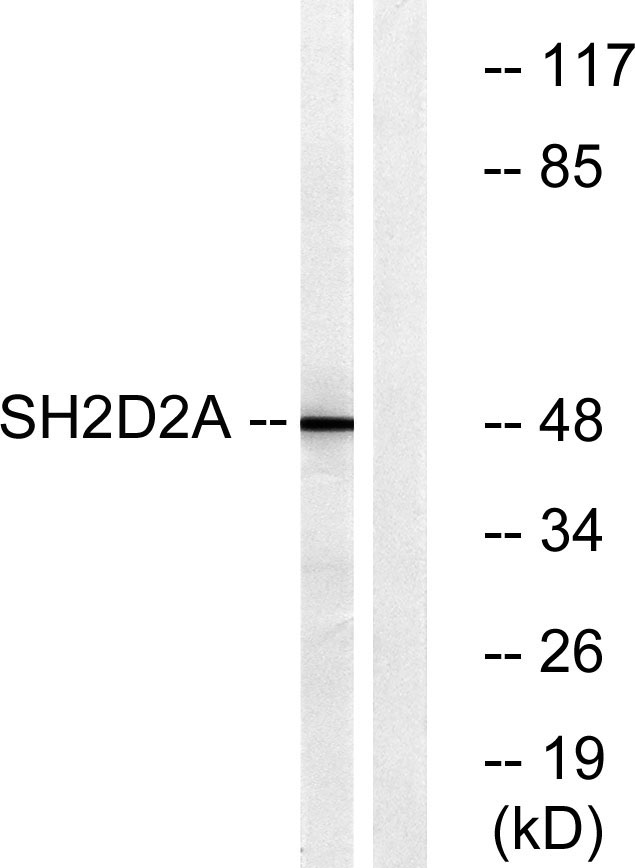 Lad Rabbit Polyclonal Antibody | 兔多抗 | EnkiLife恩玑生命