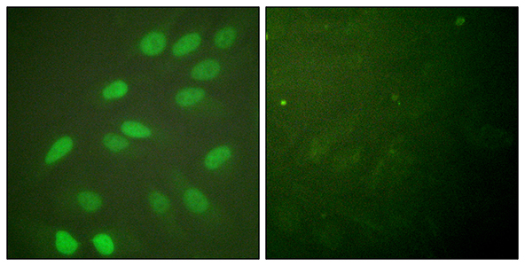 Lamin A/C Rabbit Polyclonal Antibody | 兔多抗 | EnkiLife恩玑生命