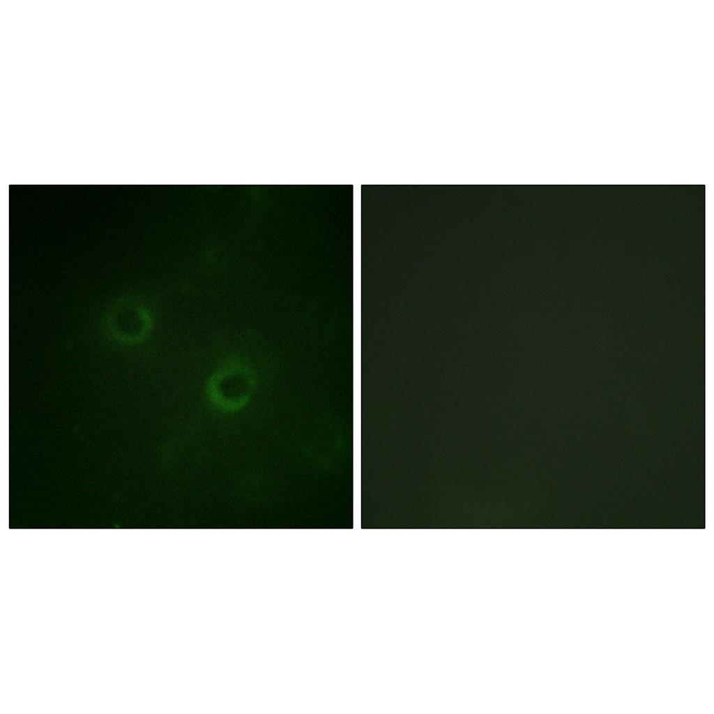 Lck Rabbit Polyclonal Antibody | 兔多抗 | EnkiLife恩玑生命