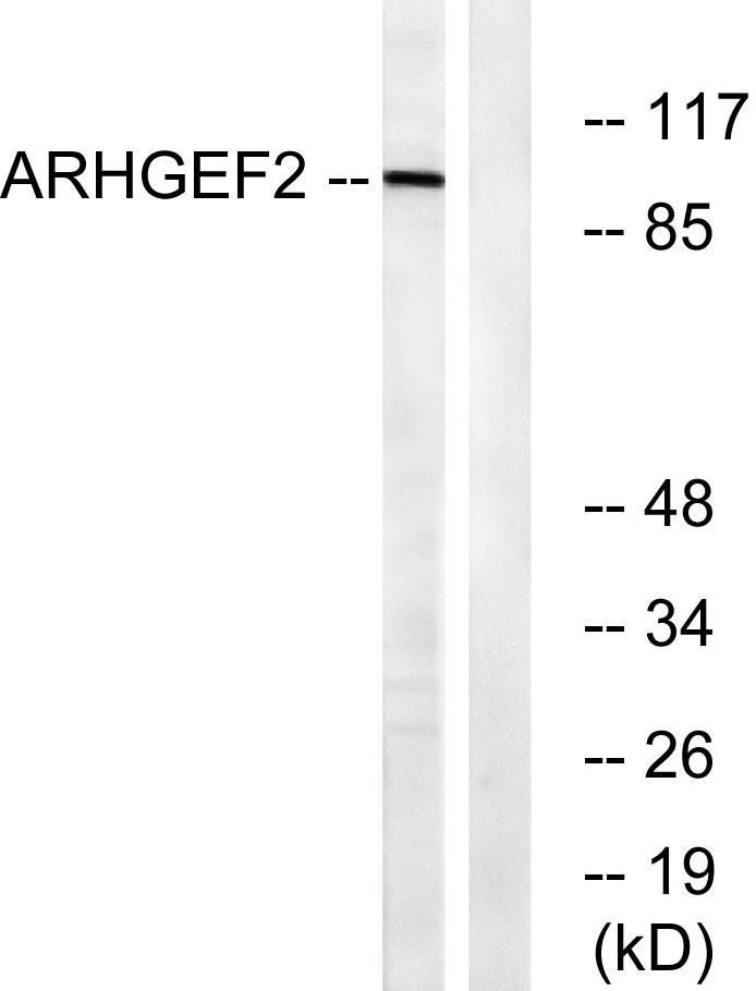 Lfc Rabbit Polyclonal Antibody | 兔多抗 | EnkiLife恩玑生命