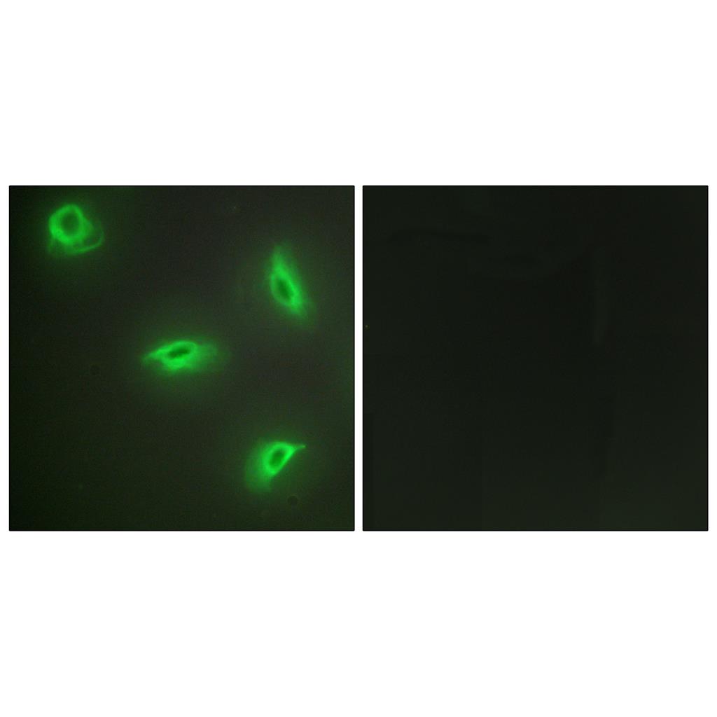 LIGHT Rabbit Polyclonal Antibody | 兔多抗 | EnkiLife恩玑生命