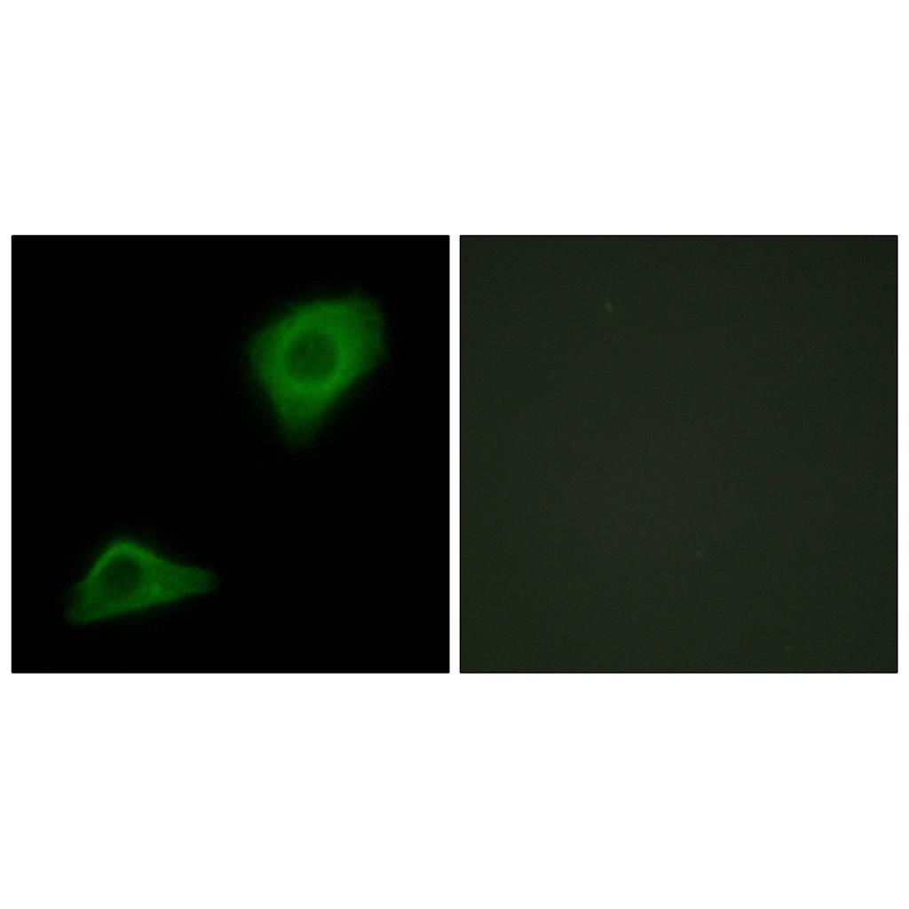 LPAAT-θ Rabbit Polyclonal Antibody | 兔多抗 | EnkiLife恩玑生命