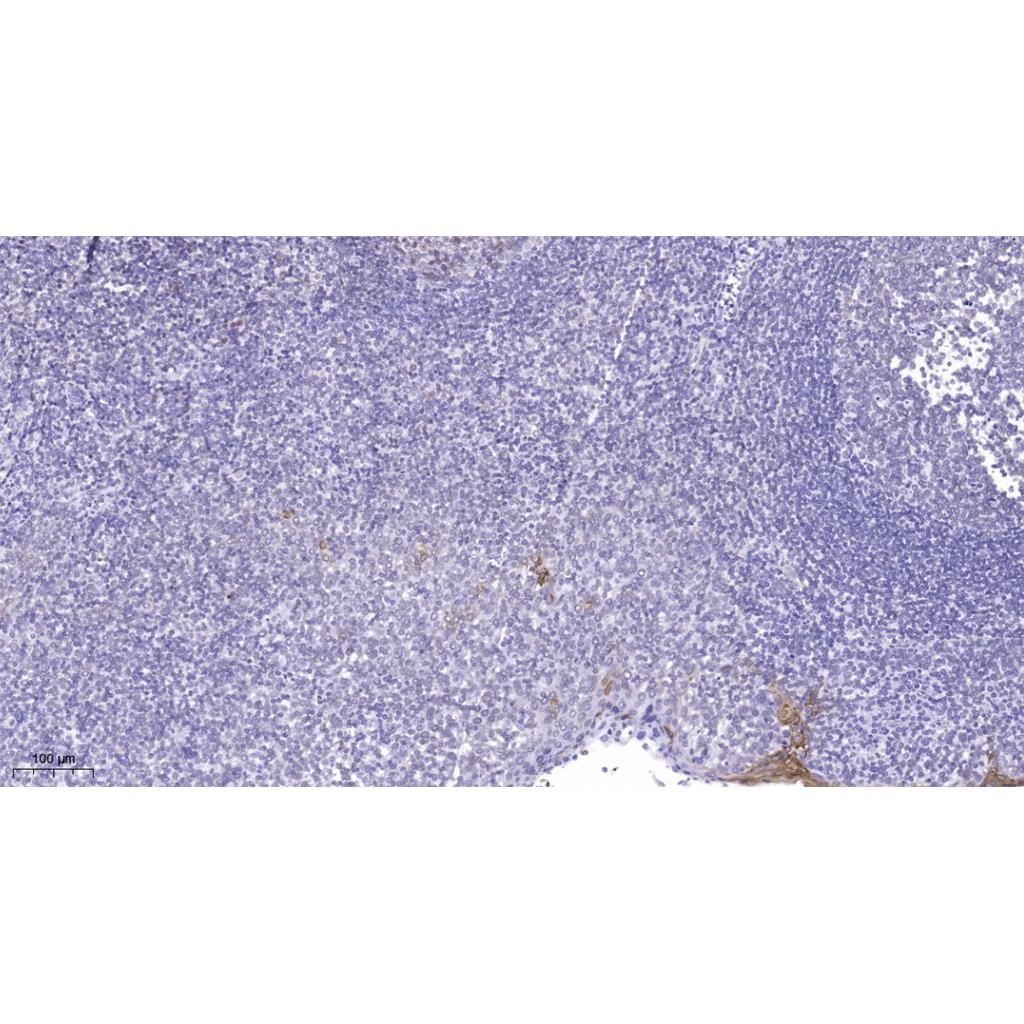 Lsk Rabbit Polyclonal Antibody | 兔多抗 | EnkiLife恩玑生命