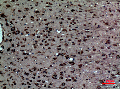 LXRα Rabbit Polyclonal Antibody | 兔多抗 | EnkiLife恩玑生命