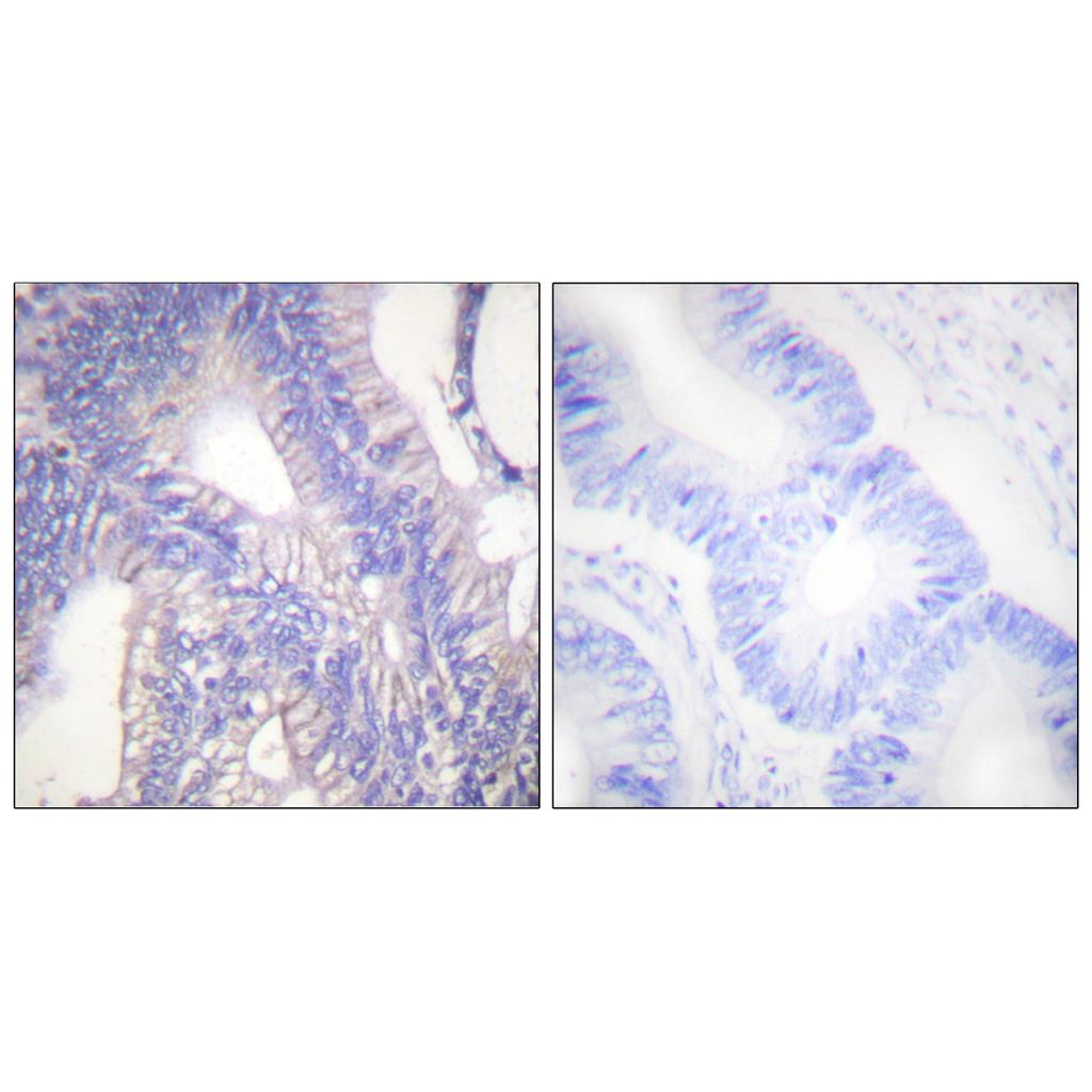 Lyn Rabbit Polyclonal Antibody | 兔多抗 | EnkiLife恩玑生命