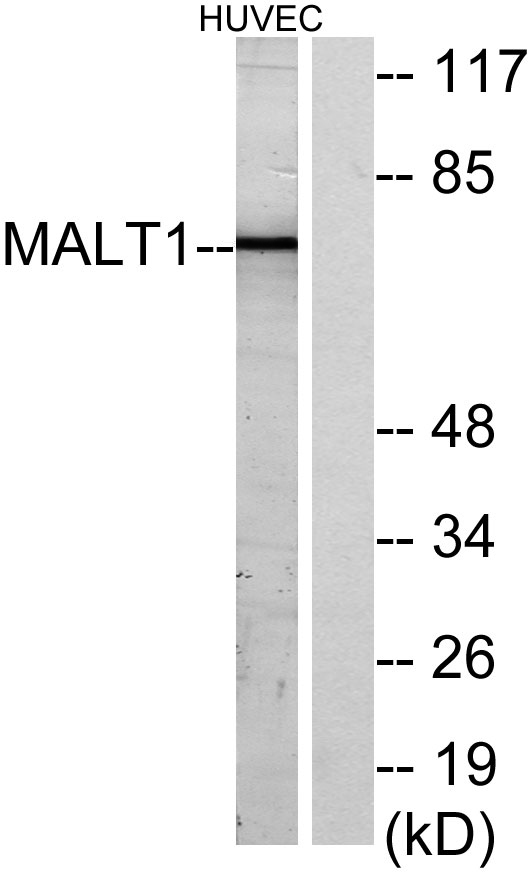 MALT1 Rabbit Polyclonal Antibody | 兔多抗 | EnkiLife恩玑生命