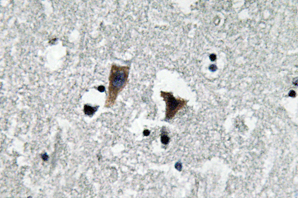 MAO-A Rabbit Polyclonal Antibody | 兔多抗 | EnkiLife恩玑生命