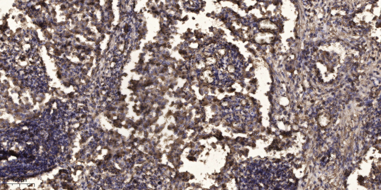 MAP1B Rabbit Polyclonal Antibody | 兔多抗 | EnkiLife恩玑生命