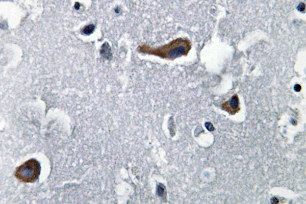 MAP-2 Rabbit Polyclonal Antibody | 兔多抗 | EnkiLife恩玑生命