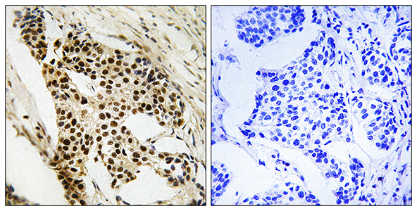 MAPKAPK-2 Rabbit Polyclonal Antibody | 兔多抗 | EnkiLife恩玑生命